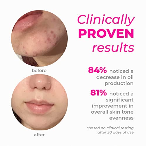 Controle cremoso de cuidados com a pele 7% Gel mandélico, acne e removedor de manchas escuras
