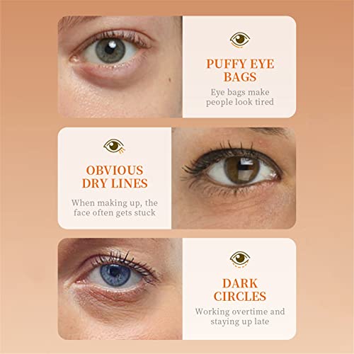 O olho de cabeça hidratante para os olhos dos olhos Vitamina C melhora os círculos escuros Linhas de