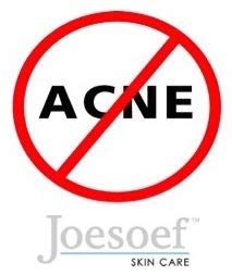 Joesoef Skin Care Soap para acne Dermatologists de grau farmacêutico aprovado para acne 4-pacote